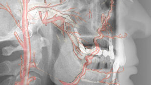 dientes_rediografia